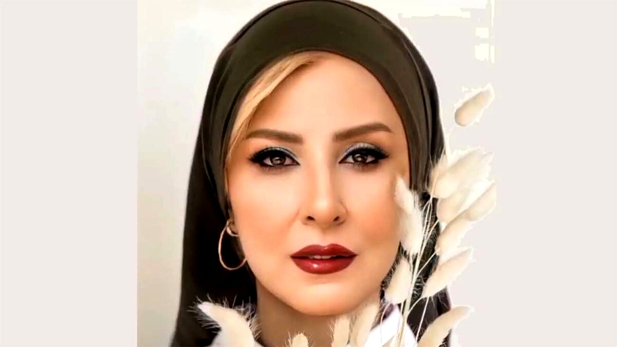مرجانه گلچین جراحی پلاستیک کرد | چهره بعد از جراحی مرجانه گلچین عقل از سر همه پروند