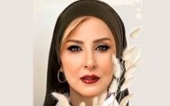 مرجانه گلچین جراحی پلاستیک کرد | چهره بعد از جراحی مرجانه گلچین عقل از سر همه پروند