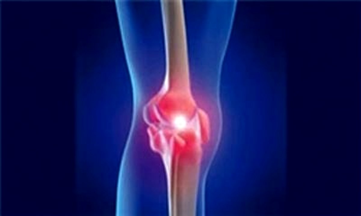 پروتئینی که آرتروز را درمان میکند!