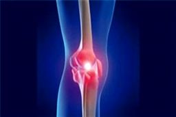 پروتئینی که آرتروز را درمان می‌کند!