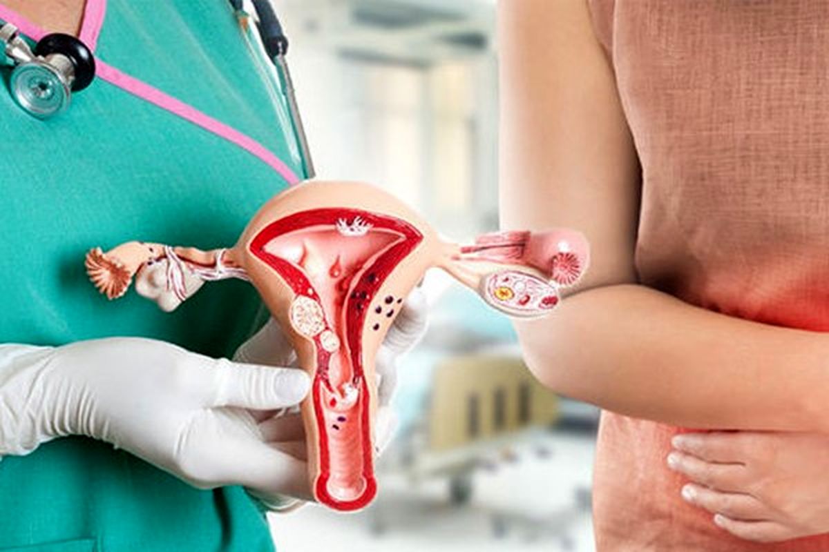 از کجا بفهمیم عفونت رحم داریم؟