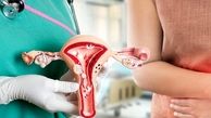 از کجا بفهمیم عفونت رحم داریم؟