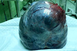 راز شکم برآمده زن اردبیلی فاش شد / همه شوکه شدند