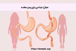 آشنایی با جنبه های مثبت و منفی عمل جراحی بای پس معده