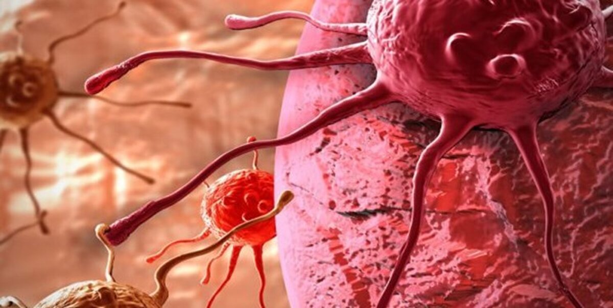 هشدار: قندخون بالا ریسک سرطان لوزالمعده را افزایش می‌دهد