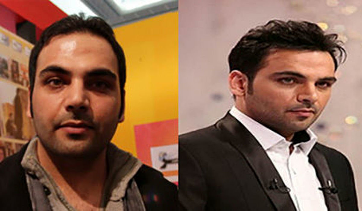 عکسهای احسان علیخانی قبل از کاشت مو لو رفت / چقدر تفاوت!!