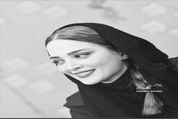تغییر چهره بهنوش طباطبایی همه را شوکه کرد 