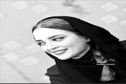 تغییر چهره بهنوش طباطبایی همه را شوکه کرد 