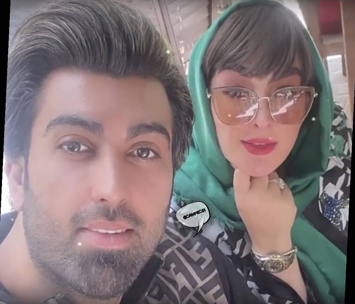 تغییر چهره عجیب الهام حمیدی با عمل زیبایی جدیدش