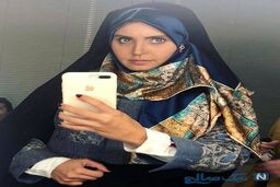 عکس عجیب الناز شاکردوست بعد از کشیدن دندان عقل! + عکس