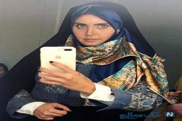 عکس عجیب الناز شاکردوست بعد از کشیدن دندان عقل! + عکس