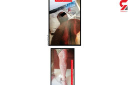  اسید پاشی بادی گارد های  کمدین ایرانی روی یک مرد ! / در مشهد رخ داد + عکس ها و رای دادگاه