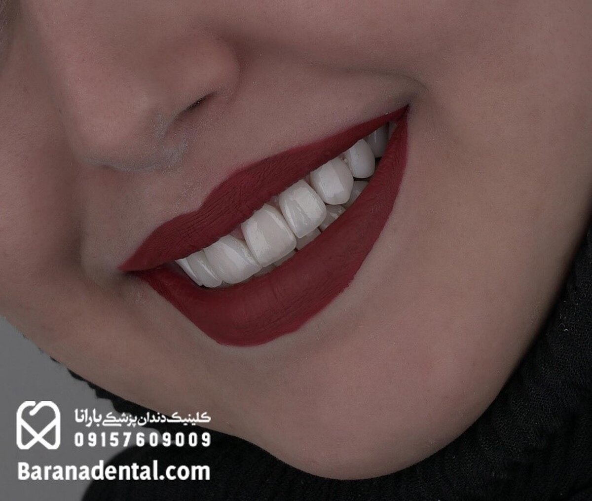 ارائه خدمات دندانپزشکی مشهد به صورت اقساطی و چکی در کلینیک بارانا
