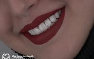 ارائه خدمات دندانپزشکی مشهد به صورت اقساطی و چکی در کلینیک بارانا