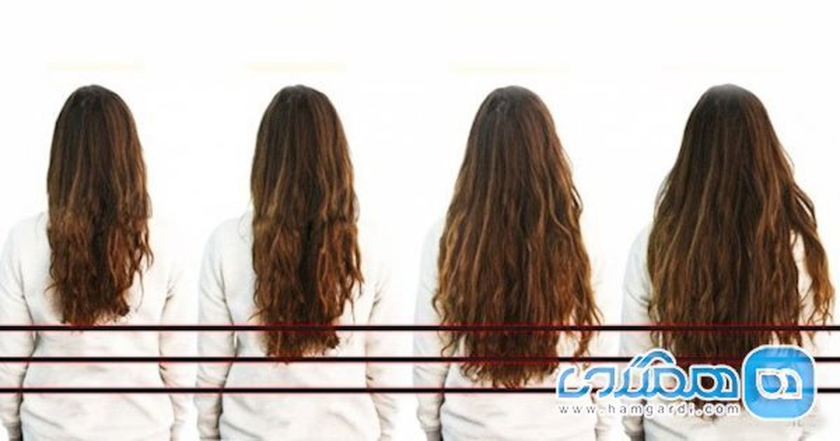 برای فرار از کچلی، این خوراکیها را بخورید