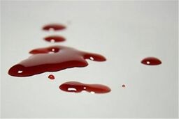 تخلیه چشم کودکی که در حال تماشای نزاع خیابانی بود/ قطع نخاع زن در درگیری مختصر خانوادگی