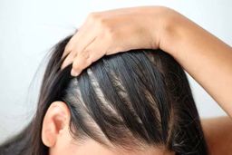 آیا شامپوهای ریزش مو واقعاً مؤثر هستند؟ حقیقت را در اینجا بدانید!