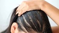 آیا شامپوهای ریزش مو واقعاً مؤثر هستند؟ حقیقت را در اینجا بدانید!