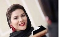 تغییر چهره 180 درجه ای سحر دولتشاهی بعد از جراحی زیبایی | اولین عکس سحر دولتشاهی بعد از عمل زیبایی همه رو محو خودش کرد