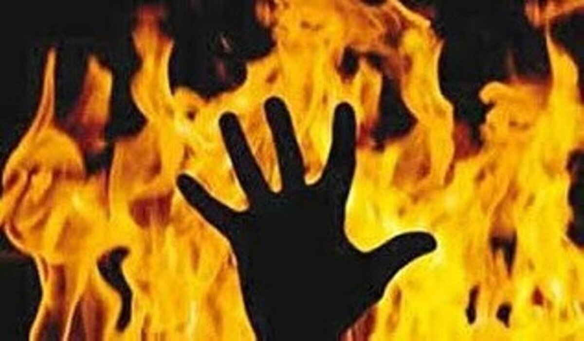مواد محترقه ۵ نوجوان مشهدی را دچار سوختگی کرد