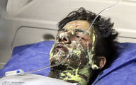 ۵۴۵ نفر در مورد حوادث چهارشنبه سوری مصدوم شدند