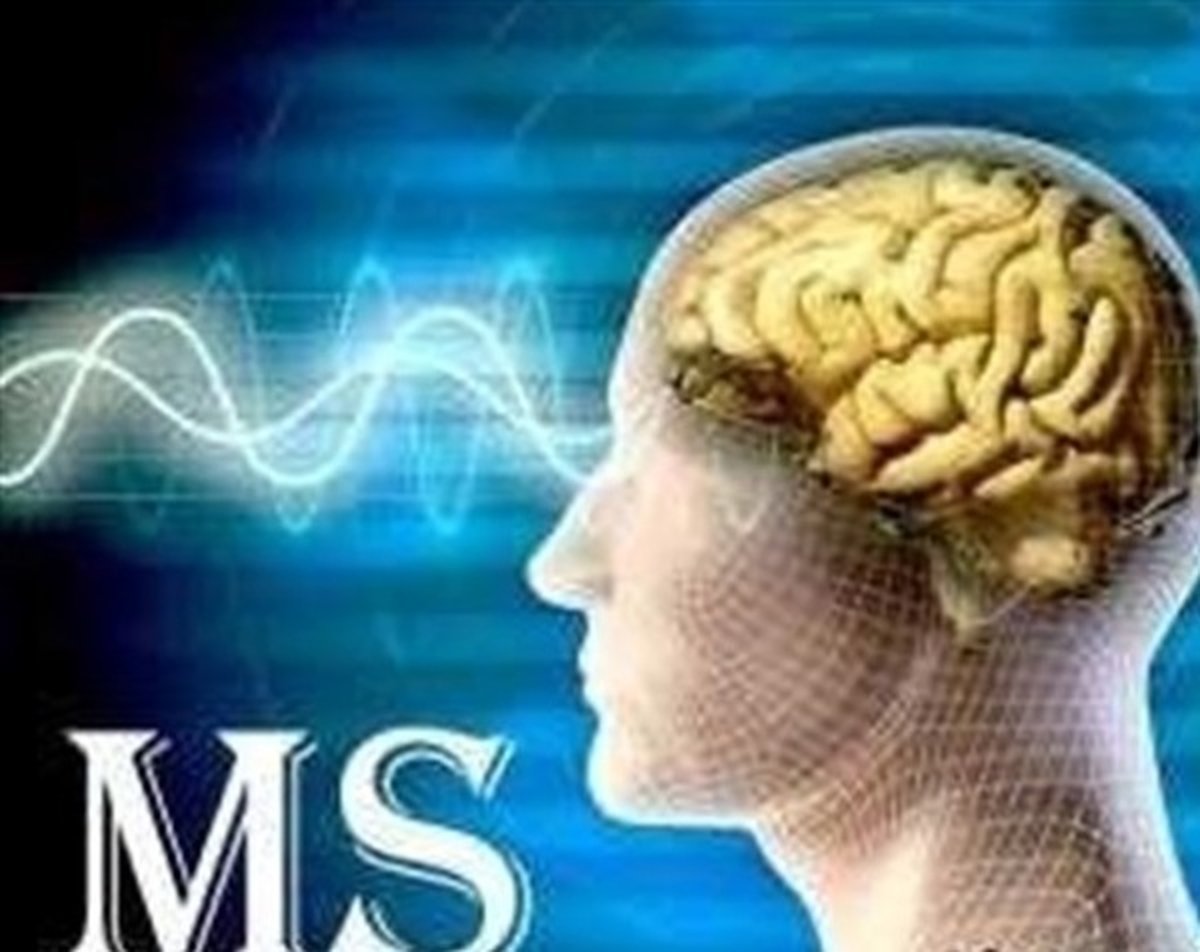 تستوسترون چطور از مردان برابر اماس حفاظت میکند؟