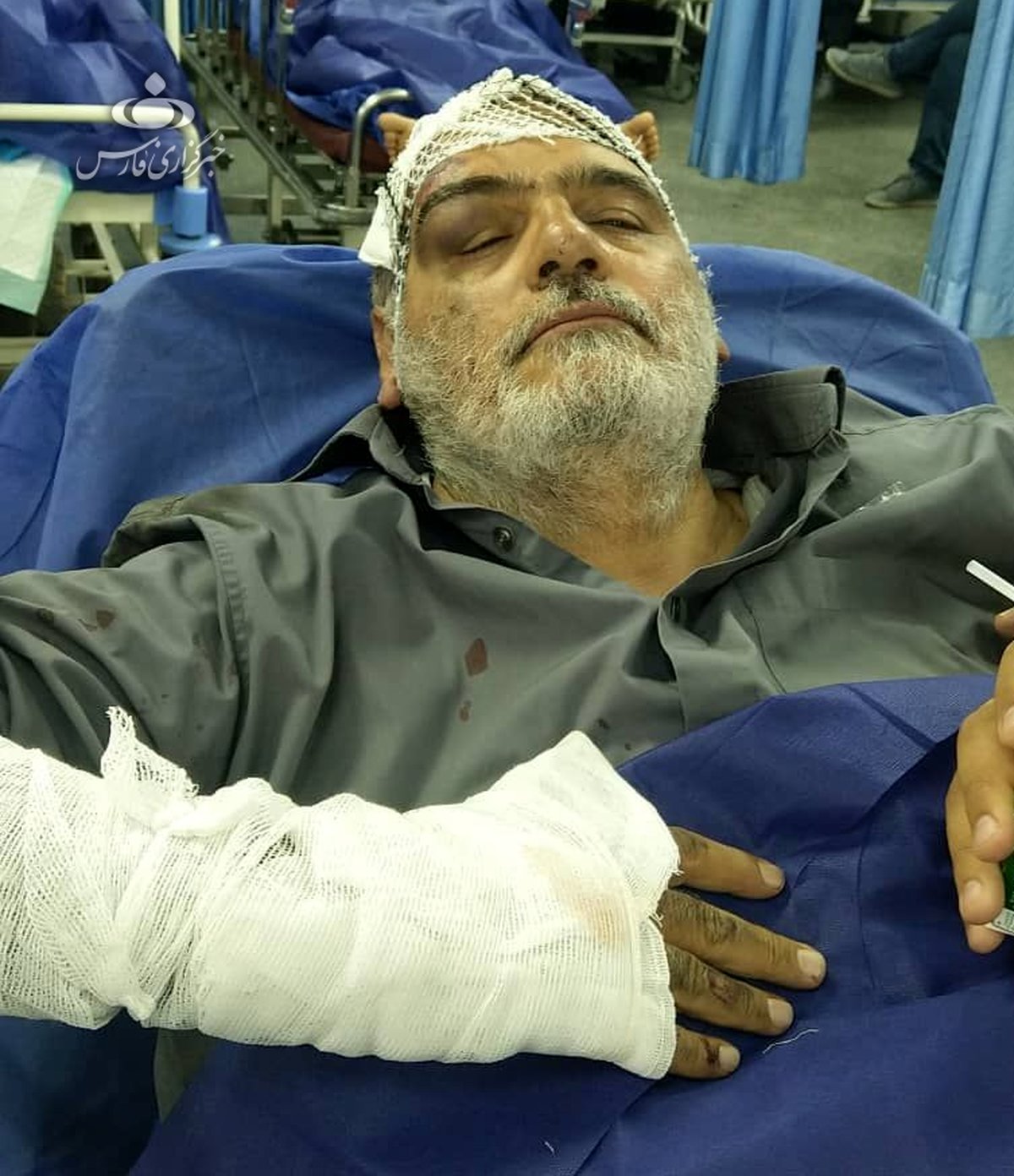 حسین الله کرم دچار سانحه رانندگی شد