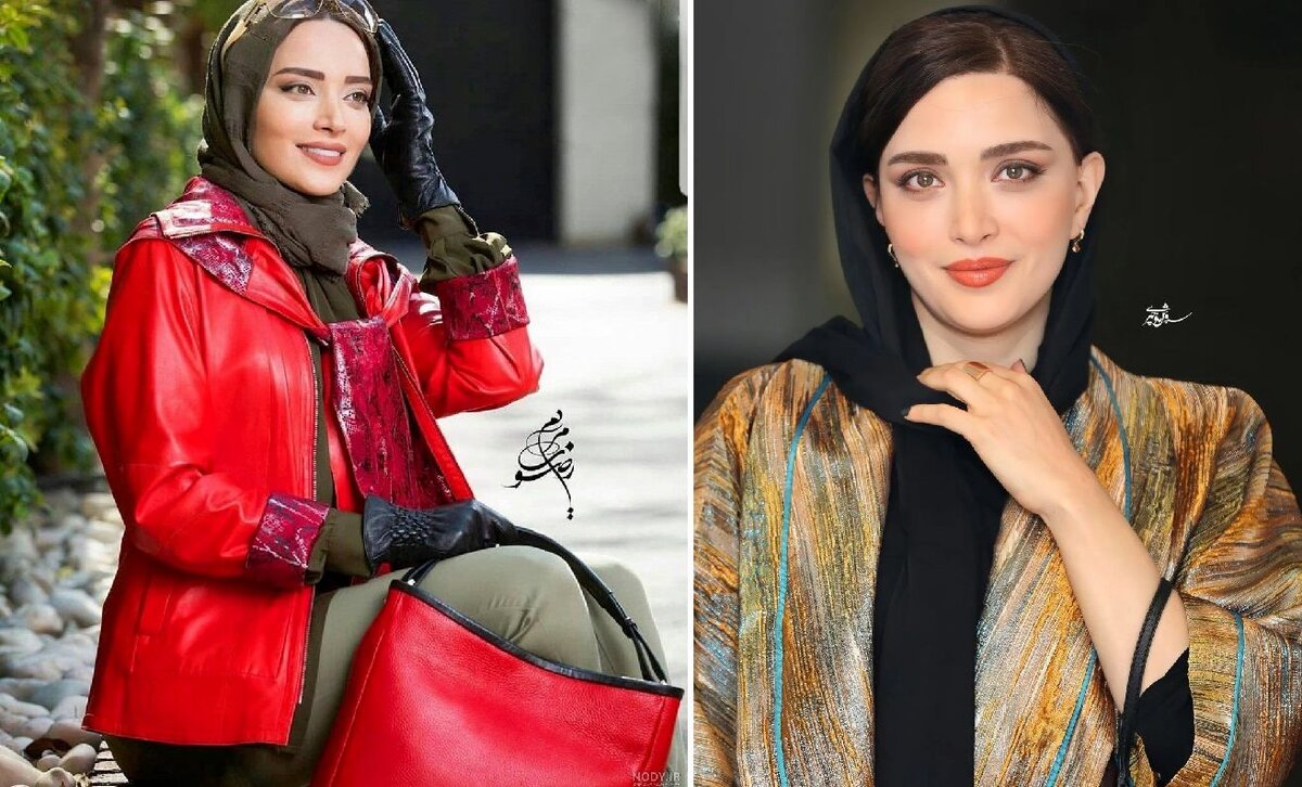 رونمایی بهنوش طباطبایی از چهره جدیدش | خانم با این عمل زیبایی 180 درجه فرق کرده