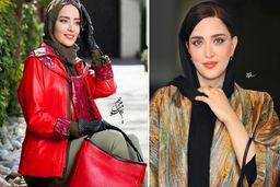 رونمایی بهنوش طباطبایی از چهره جدیدش | خانم با این عمل زیبایی 180 درجه فرق کرده