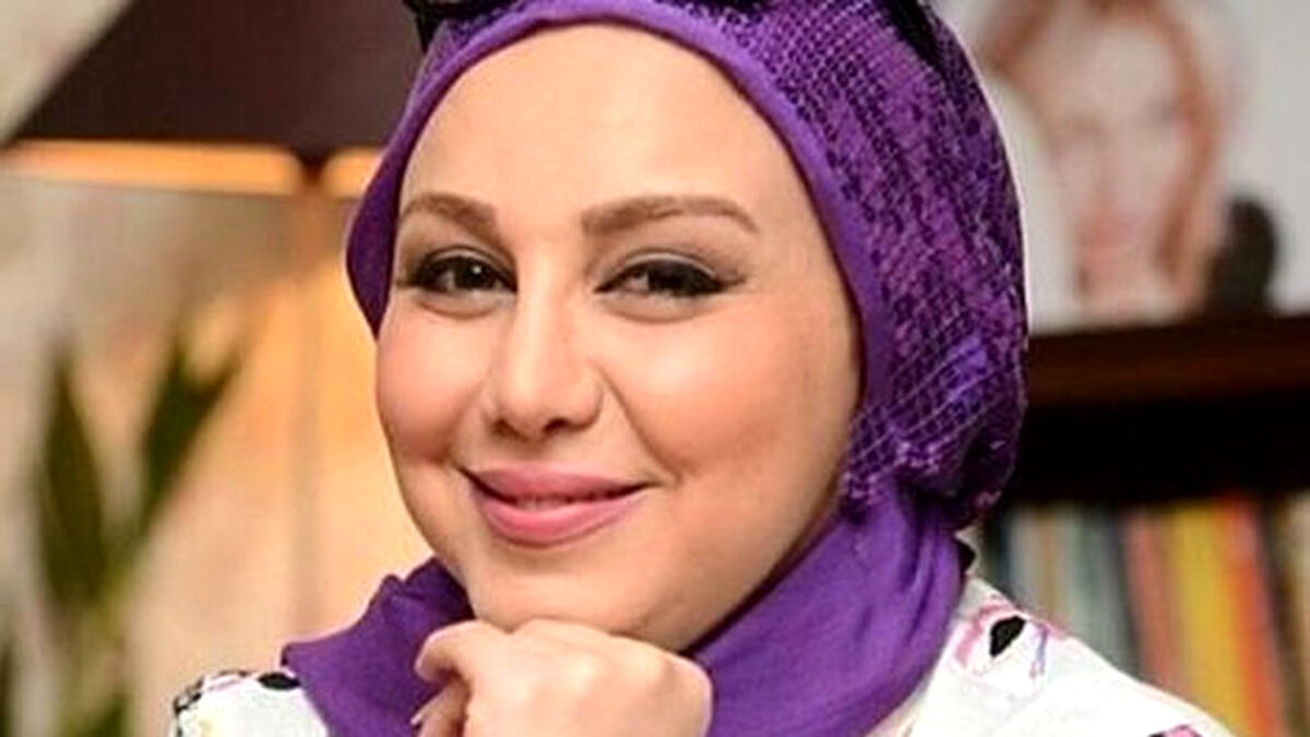 چهره بهنوش بختیاری بعد از عمل زیبایی جدید | عینک میلیاردی بهنوش بختیاری همه را شوکه کرد