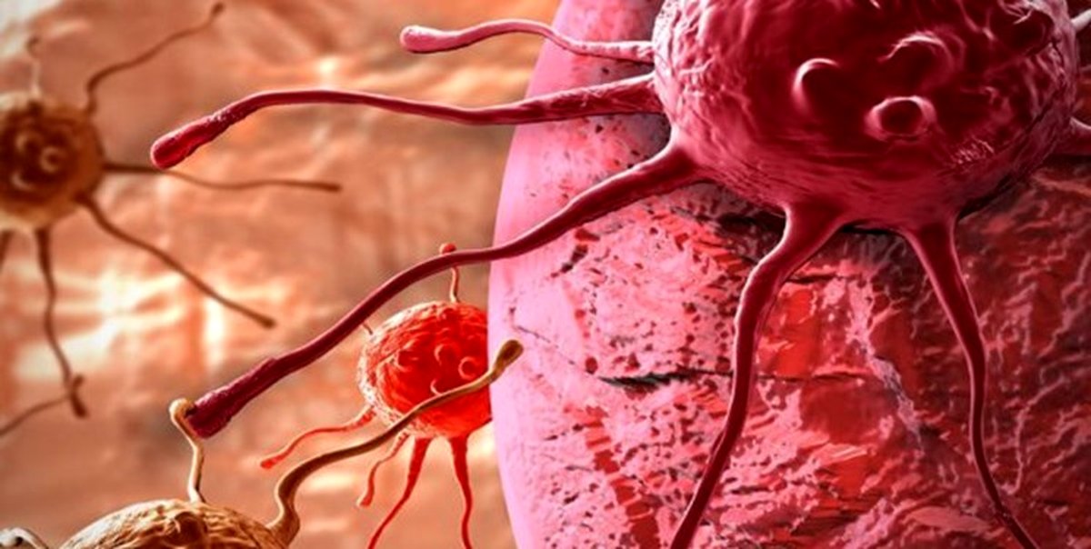 درمان قطعی دو سوم سرطانها در ایران