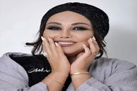 رونمایی بهنوش بختیاری از چهره جدیدش بعد از عمل زیبایی | عمرا اگر بهنوش بختیاری تو این عکس بشناسین