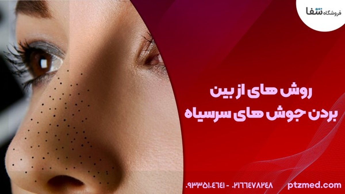 از بین بردن جوش سر سیاه با 3 روش راحت و آسان | دستگاه هایفو ، دستگاه آر اف فرکشنال و دستگاه میکرونیدلینگ