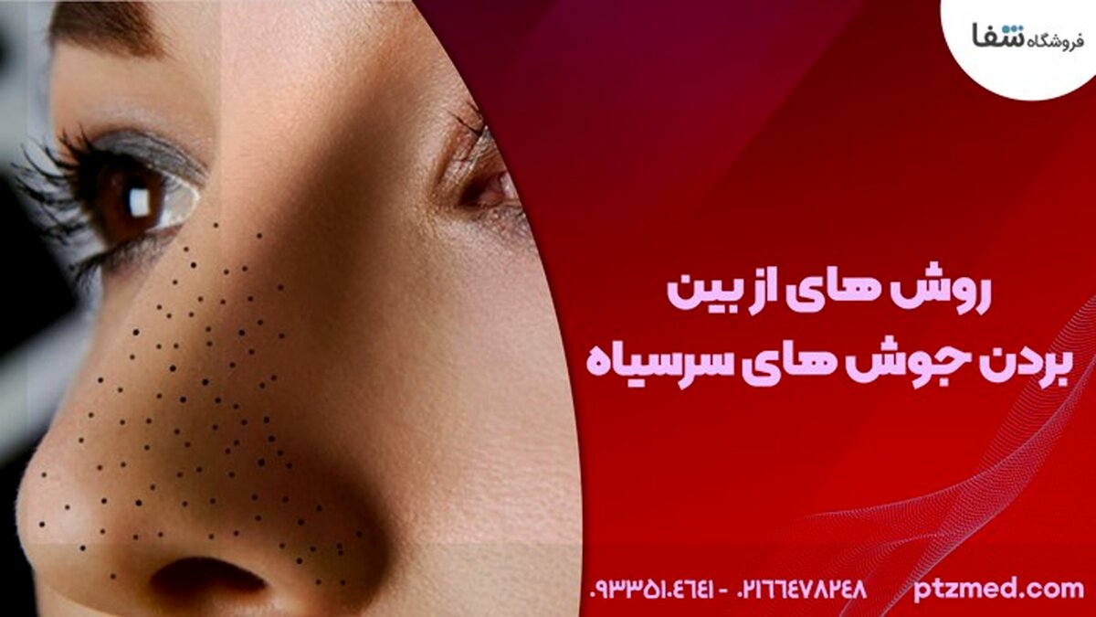 از بین بردن جوش سر سیاه با 3 روش راحت و آسان | دستگاه هایفو ، دستگاه آر اف فرکشنال و دستگاه میکرونیدلینگ