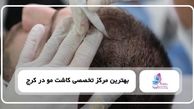 قبل از کاشت مو چه نکاتی را باید رعایت کرد؟ چک لیست آمادگی برای بهترین نتیجه 