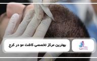 قبل از کاشت مو چه نکاتی را باید رعایت کرد؟ چک لیست آمادگی برای بهترین نتیجه 
