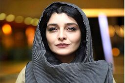 تغییر چهره وحشتناک ساره بیات | چه بر سر ساره بیات آمده است ؟
