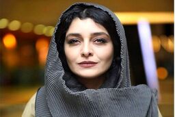 تغییر چهره وحشتناک ساره بیات | چه بر سر ساره بیات آمده است ؟
