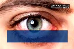 این ۱۱ علت چشم‌درد را حتماً جدی بگیرید