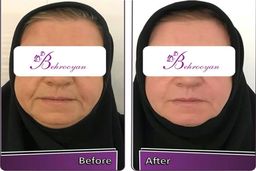 بهرویان معتبرترین کلینیک جراحی زیبایی در تهران  