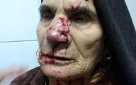 حمله گرگ‌های گرسنه به دو زن در خلخال+ عکس