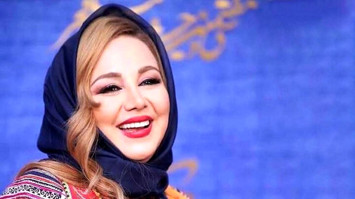عکس جدید بهنوش بختیاری بعد عمل زیبایی | خانوم شما دیگه ازت سنی گذشته این چه کاریه