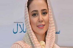 رونمایی الناز حبیبی از چهره بعد از عمل زیباییش | خانم با عمل بینیش دیگه قابل شناسایی نیست
