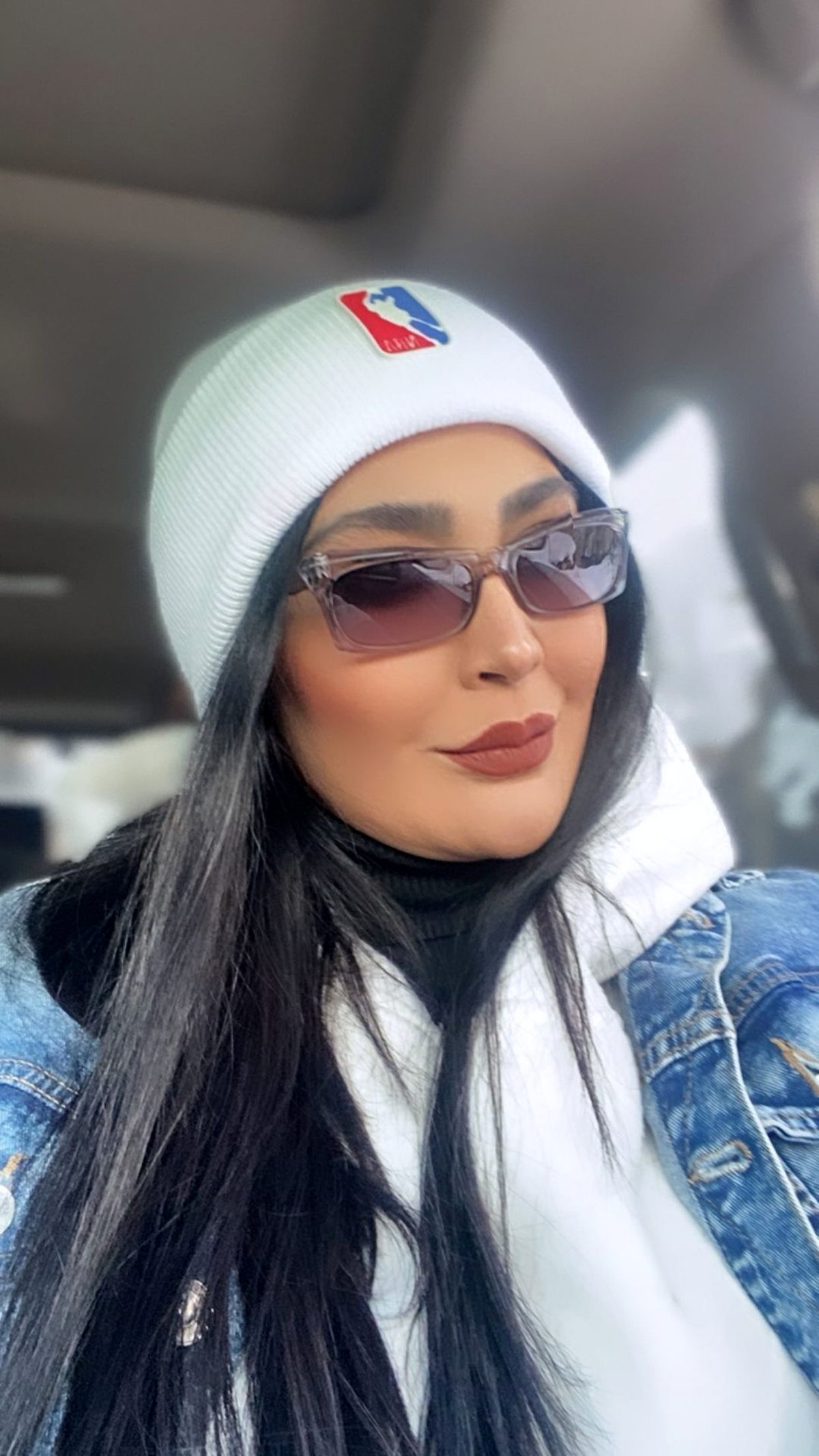 مریم معصومی بعد از عمل زیبایی