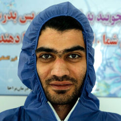 اثر جای ماسک بر صورت جهادگران سلامت