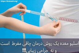 عمل اسلیو معده چیست و چه نکاتی دارد؟