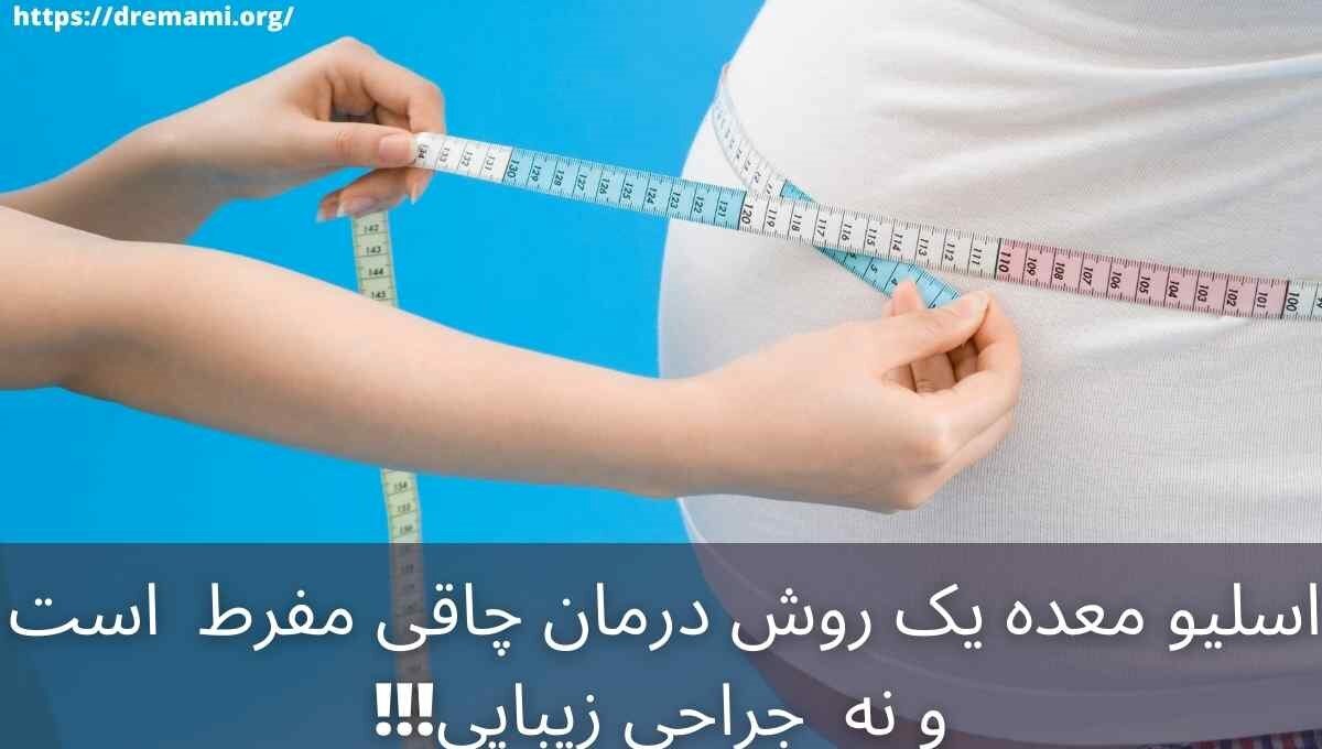عمل اسلیو معده چیست و چه نکاتی دارد؟
