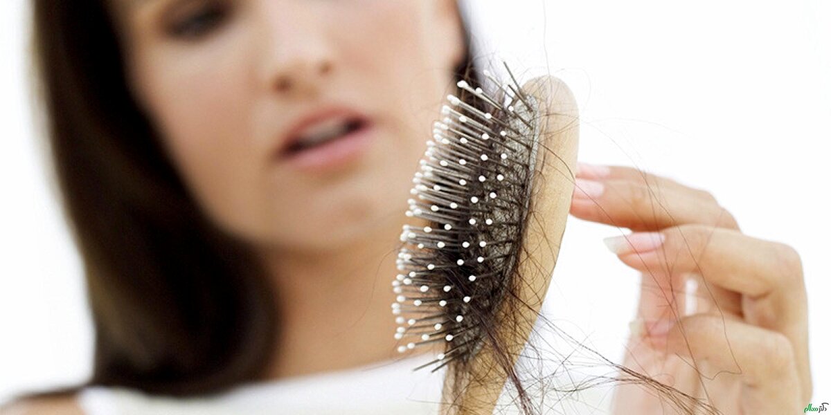 چگونه با پیاز ریزش موهایمان را از بین ببریم؟