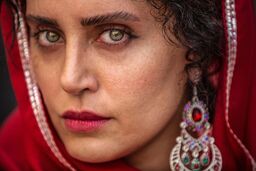الناز شاکر دوست با چهره زخمی 