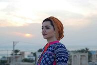 تغییر 180 درجه ای نازنین بیاتی بعد از عملش | خانم با این جراحی زیبایی کلا یه آدم دیگه شد